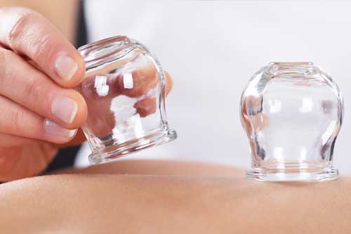 Prentice Sorts Therapy cupping link